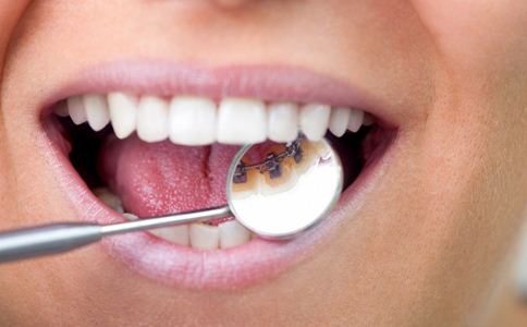 刷牙用力蛀牙找上门 七个坏习惯致蛀牙 蛀牙的原因 蛀牙怎么办 哪些坏习惯导致蛀牙